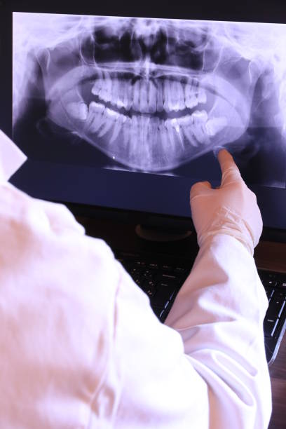 Best Emergency Root Canal Therapy in Chariton, IA